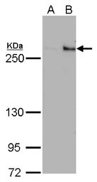 Anti-TET1 antibody [GT1462] used in Western Blot (WB). GTX627420