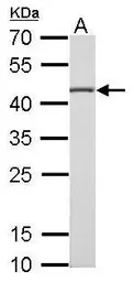 Anti-Citrate synthase antibody [GT1761] used in Western Blot (WB). GTX628143