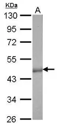 Anti-Citrate synthase antibody [GT1761] used in Western Blot (WB). GTX628143