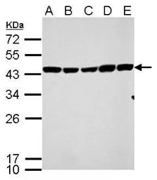 Anti-Citrate synthase antibody [GT1761] used in Western Blot (WB). GTX628143