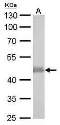 Anti-IDH2 antibody [GT673] used in Western Blot (WB). GTX628487