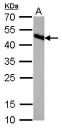 Anti-IDH2 antibody [GT673] used in Western Blot (WB). GTX628487