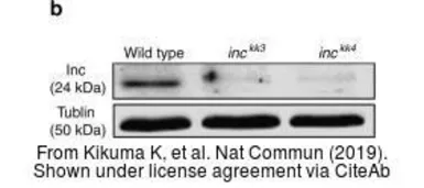 Anti-alpha Tubulin antibody [GT114] used in Western Blot (WB). GTX628802