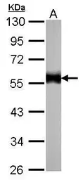 Anti-alpha Tubulin antibody [GT114] used in Western Blot (WB). GTX628802