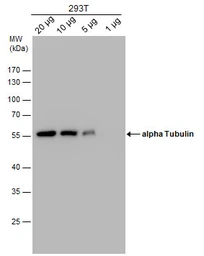 Anti-alpha Tubulin antibody [GT114] used in Western Blot (WB). GTX628802