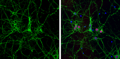 Anti-alpha Tubulin antibody [GT114] used in Immunocytochemistry/ Immunofluorescence (ICC/IF). GTX628802