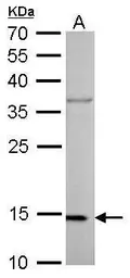 Anti-COX4 antibody [GT854] used in Western Blot (WB). GTX628901