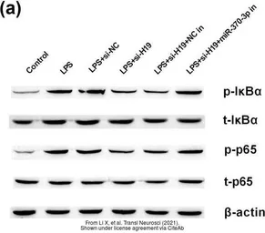 Anti-beta Actin antibody [GT5512] used in Western Blot (WB). GTX629630