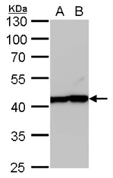 Anti-beta Actin antibody [GT5512] used in Western Blot (WB). GTX629630