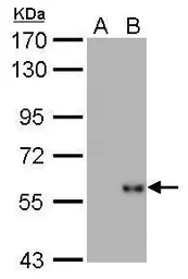 Anti-Influenza A virus Nucleoprotein antibody [GT1236] used in Western Blot (WB). GTX629633