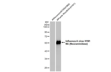 Anti-Influenza A virus H1N1 NA (Neuraminidase) antibody [GT288] used in Western Blot (WB). GTX629696