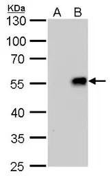 Anti-Influenza A virus H1N1 NA (Neuraminidase) antibody [GT288] used in Western Blot (WB). GTX629696