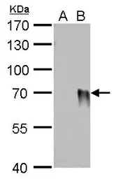 Anti-Influenza A virus H1N1 HA (Hemagglutinin) antibody [GT223] used in Western Blot (WB). GTX629750