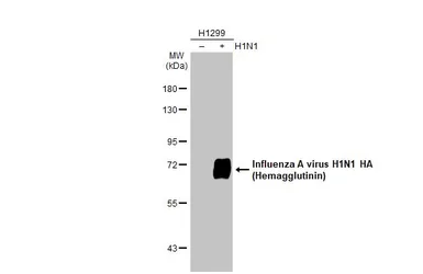 Anti-Influenza A virus H1N1 HA (Hemagglutinin) antibody [GT223] used in Western Blot (WB). GTX629750