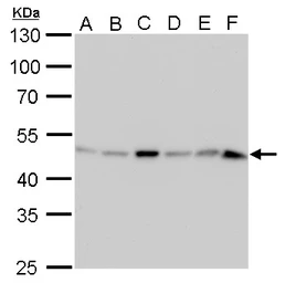 Anti-IDH1 antibody [GT1521] used in Western Blot (WB). GTX629818