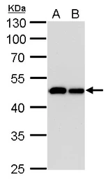 Anti-IDH1 antibody [GT1521] used in Western Blot (WB). GTX629818