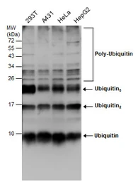 Anti-Ubiquitin antibody [GT7811] used in Western Blot (WB). GTX630148