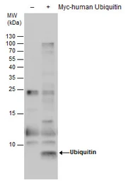 Anti-Ubiquitin antibody [GT7811] used in Western Blot (WB). GTX630148