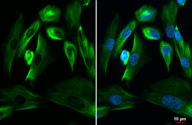 Anti-Nestin antibody [GT623] used in Immunocytochemistry/ Immunofluorescence (ICC/IF). GTX630201