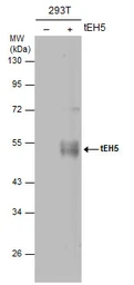 Anti-Avian Influenza A virus H5N1 HA (Hemagglutinin) antibody [1D10] used in Western Blot (WB). GTX632358