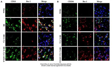 Anti-Iba1 antibody [GT10312] used in  (). GTX632426