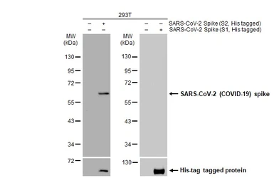 Anti-SARS-CoV / SARS-CoV-2 (COVID-19) spike antibody [1A9] used in Western Blot (WB). GTX632604