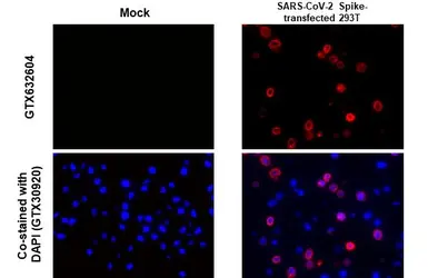 Anti-SARS-CoV / SARS-CoV-2 (COVID-19) spike antibody [1A9] used in IHC-P (cell pellet) (IHC-P (cell pellet)). GTX632604