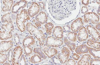 Anti-SDHA antibody [GT20710] used in IHC (Paraffin sections) (IHC-P). GTX632636