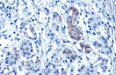 Anti-Glypican-3 antibody [GT2473] used in IHC (Paraffin sections) (IHC-P). GTX633410