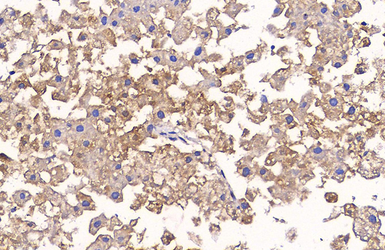 Anti-Glypican-3 antibody [GT2473] used in IHC (Paraffin sections) (IHC-P). GTX633410