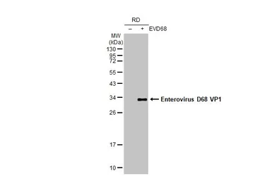 Anti-Enterovirus D68 VP1 antibody [GT11610] used in Western Blot (WB). GTX633688