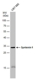 Anti-Syntenin 1 antibody [GT1523] used in Western Blot (WB). GTX634154