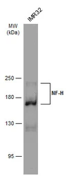 Anti-NF-H antibody [GT114] used in Western Blot (WB). GTX634289