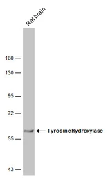 Anti-Tyrosine Hydroxylase antibody [GT234] used in Western Blot (WB). GTX634481
