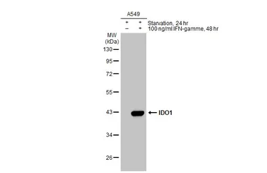 Anti-IDO1 antibody [GT273] used in Western Blot (WB). GTX634652