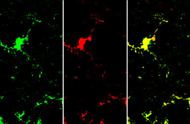 Anti-Iba1 antibody [HL22] used in IHC (Frozen sections) (IHC-Fr). GTX635363
