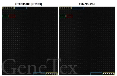 Anti-CA19-9 antibody [GT933] used in Glycan Array (Glycan Array). GTX635389