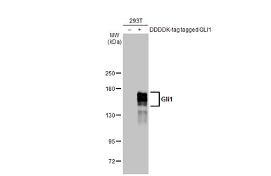Anti-Gli1 antibody [HL247] used in Western Blot (WB). GTX635619