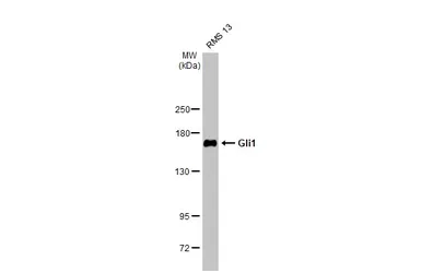 Anti-Gli1 antibody [HL247] used in Western Blot (WB). GTX635619