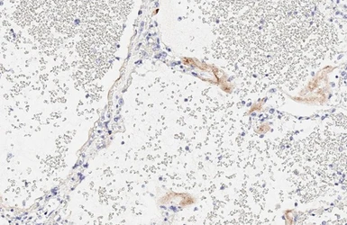 Anti-SARS-CoV-2 (COVID-19) Spike S1 antibody [HL6] used in IHC (Paraffin sections) (IHC-P). GTX635654