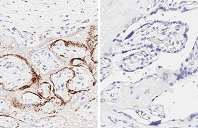 Anti-SARS-CoV-2 (COVID-19) Spike S1 antibody [HL6] used in IHC (Paraffin sections) (IHC-P). GTX635654