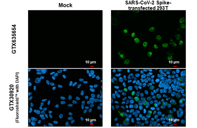 Anti-SARS-CoV-2 (COVID-19) Spike S1 antibody [HL6] used in Immunocytochemistry/ Immunofluorescence (ICC/IF). GTX635654