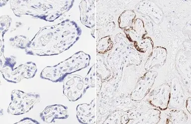 Anti-SARS-CoV-2 (COVID-19) Spike RBD antibody [HL257] used in IHC (Paraffin sections) (IHC-P). GTX635692
