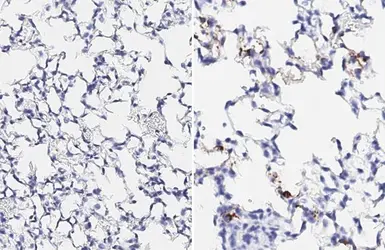 Anti-SARS-CoV-2 (COVID-19) Spike RBD antibody [HL257] used in IHC (Paraffin sections) (IHC-P). GTX635692