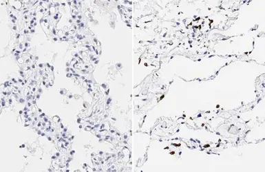 Anti-SARS-CoV-2 (COVID-19) Spike RBD antibody [HL257] used in IHC (Paraffin sections) (IHC-P). GTX635692