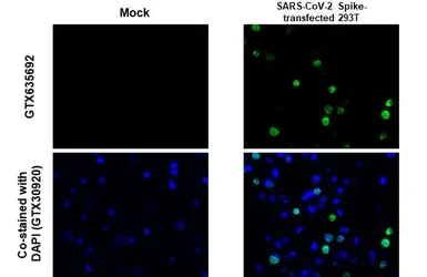 Anti-SARS-CoV-2 (COVID-19) Spike RBD antibody [HL257] used in IHC-P (cell pellet) (IHC-P (cell pellet)). GTX635692