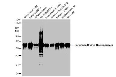 Anti-Influenza B virus Nucleoprotein antibody [HL1069] used in Western Blot (WB). GTX636100