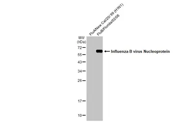 Anti-Influenza B virus Nucleoprotein antibody [HL1069] used in Western Blot (WB). GTX636100