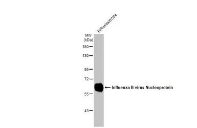Anti-Influenza B virus Nucleoprotein antibody [HL1069] used in Western Blot (WB). GTX636100