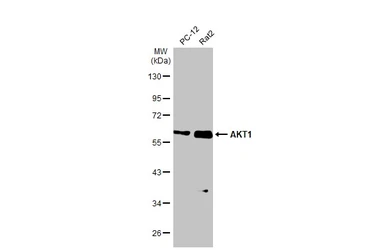 Anti-AKT1 antibody [HL1142] used in Western Blot (WB). GTX636413